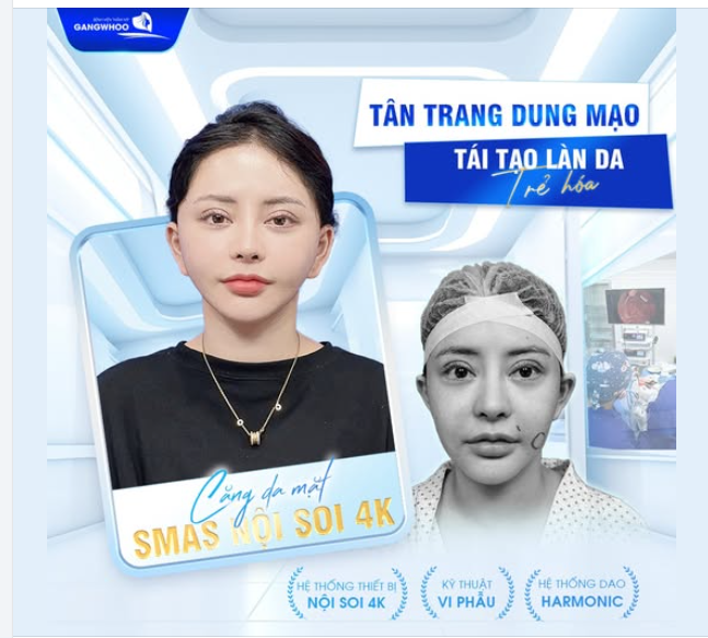 CĂNG DA MẶT SMAS NỘI SOI 4K TÂN TRANG DUNG MẠO TÁI TẠO LÀN DA TRẺ HÓA