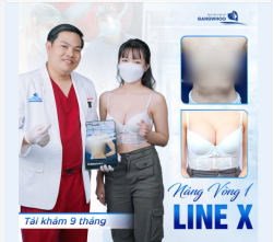 NÂNG VÒNG 1 LINEX - TÁI KHÁM 9 THÁNG