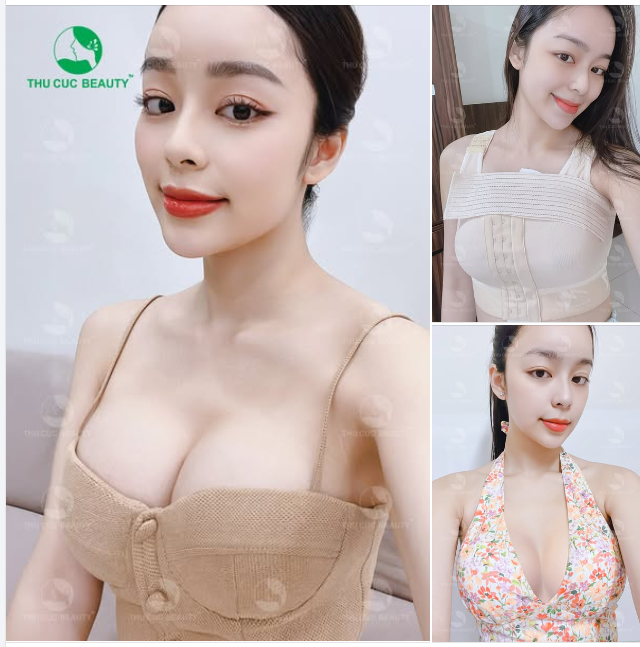 Chọn Túi ngực cao cấp chính hãng, lựa chọn size túi ngực phù hợp