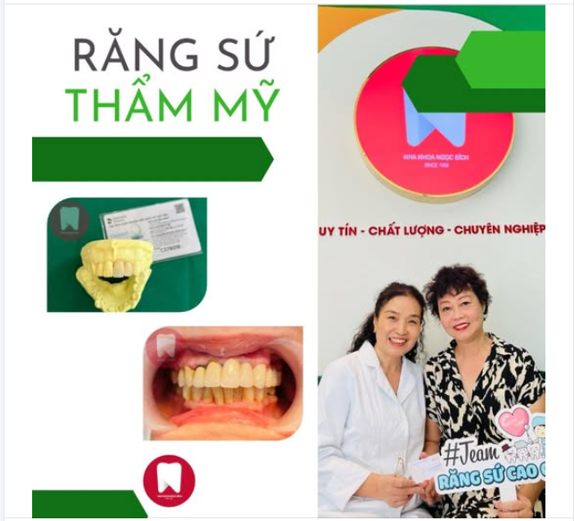 RĂNG SỨ THẨM MỸ  ĐẶC ĐIỂM CỦA RĂNG CHỤP TOÀN SỨ: