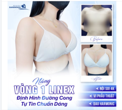 NÂNG VÒNG 1 LINEX - ĐỊNH HÌNH ĐƯỜNG CONG, TỰ TIN CHUẨN DÁNG