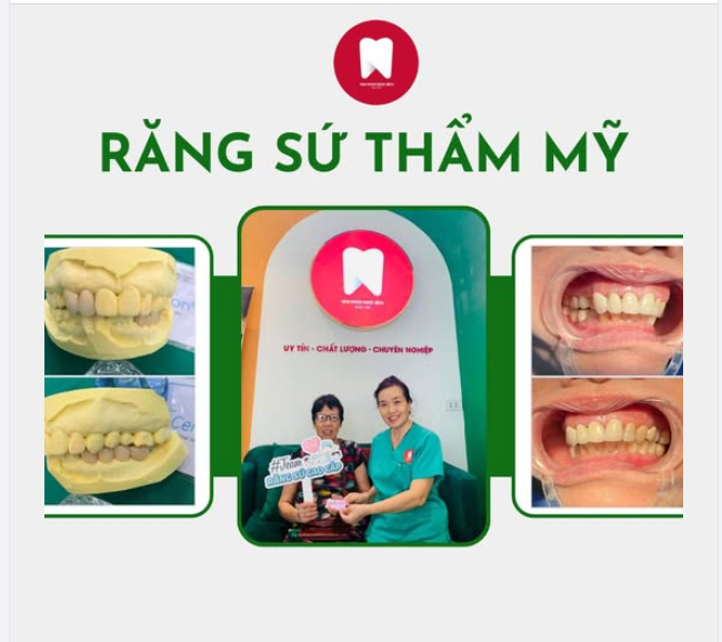 AN TÂM THIẾT KẾ NỤ CƯỜI VỚI RĂNG SỨ CHÍNH HÃNG 100%