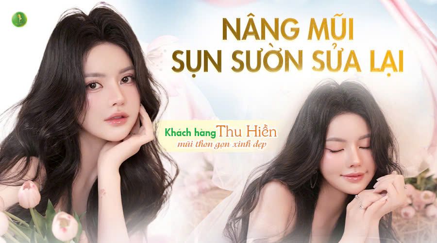 LỘT XÁC NHAN SẮC NGOẠN MỤC SAU KHI SỬA LẠI MŨI VỚI SỤN SƯỜN