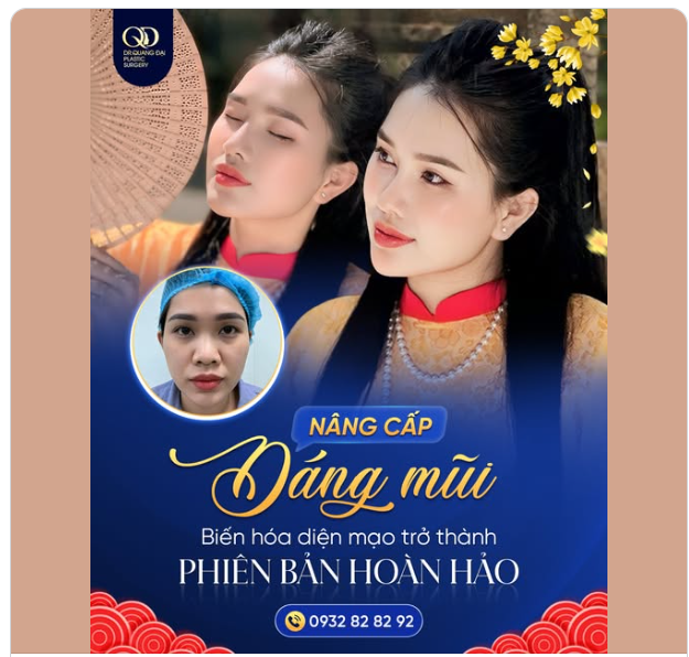 Mũi đẹp đón Tết