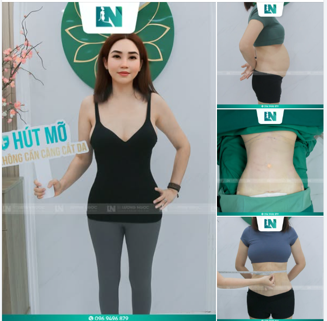 TIN ĐƯỢC KHÔNG Vóc dáng “ngọc ngà” này của một chị khách đã trải qua 4 lần sinh nở.