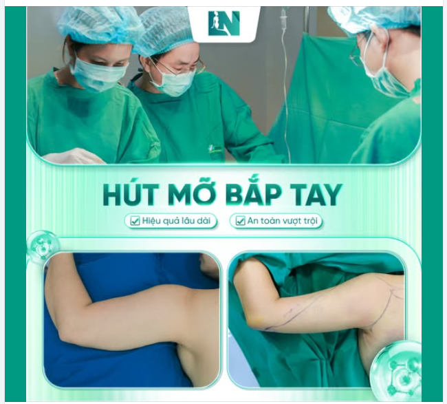 “Bắp tay đô” – luôn là nỗi ám ảnh của nhiều chị em, không chỉ làm ảnh hưởng đến vẻ ngoài mà còn khiến phái đẹp mất tự tin và khó khăn trong việc chọn lựa trang phục phù hợp.