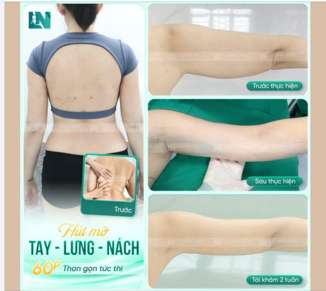 60 PHÚT KHÔNG CÒN MỠ TAY-LƯNG-NÁCH...!