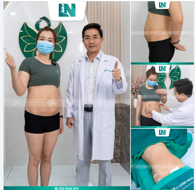 BÀ MẸ 4 CON - TÌM LẠI DÁNG CHUẨN