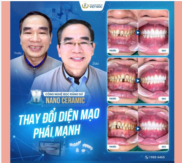 NỤ CƯỜI LỊCH LÃM, FORM RĂNG MẠNH MẼ - BÍ QUYẾT THÀNH CÔNG CỦA NGƯỜI ĐÀN ÔNG HIỆN ĐẠI