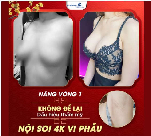 NÂNG V1 CẬN TẾT VẪN XINH ĐẸP TỰ NHIÊN
