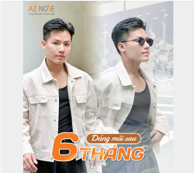 GenZ "cực bảnh" với giao diện mới sau 6 tháng tái tạo mũi hỏng