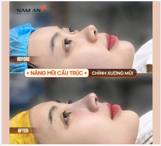 ĐẾN NAM AN MŨI ĐẸP TRONG TẦM TAY
