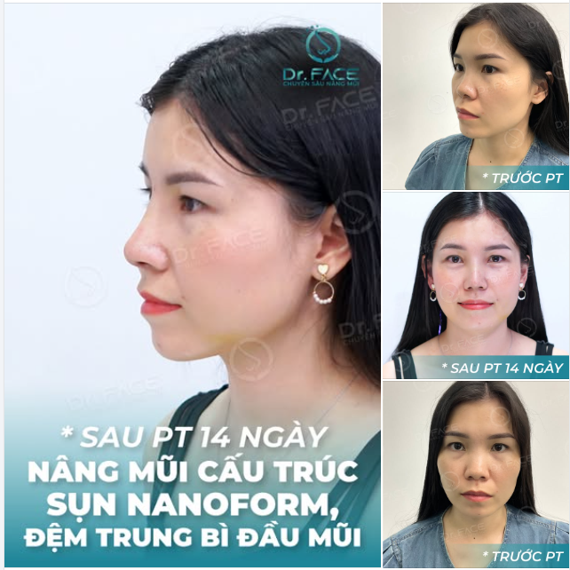 Bất ngờ TIỀN MÊ: Nhát như mình cũng KHÔNG THẤY Đ AU