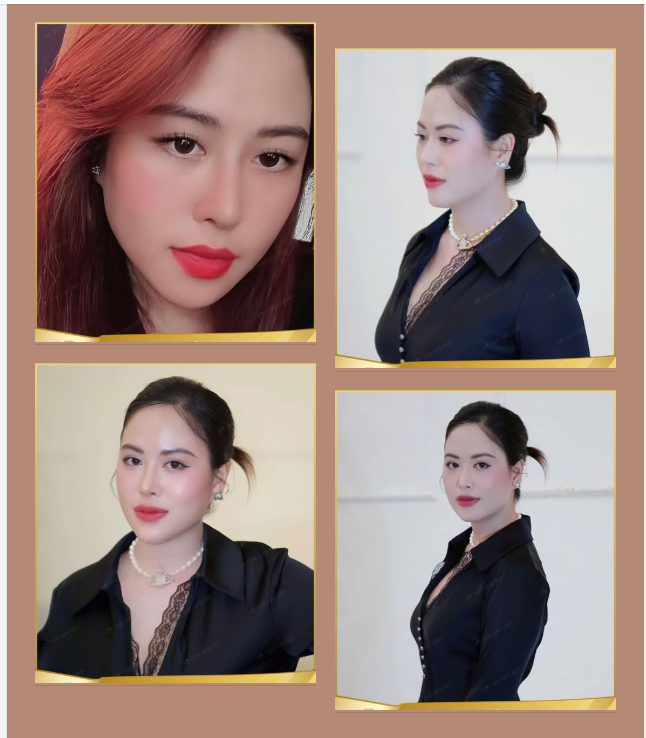 Nâng mũi sử dụng trong nâng mũi cần có độ tương thích tốt với cơ thể.