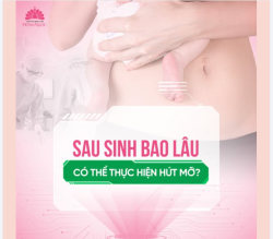 SAU SINH BAO LÂU CÓ THỂ THỰC HIỆN HÚT MỠ