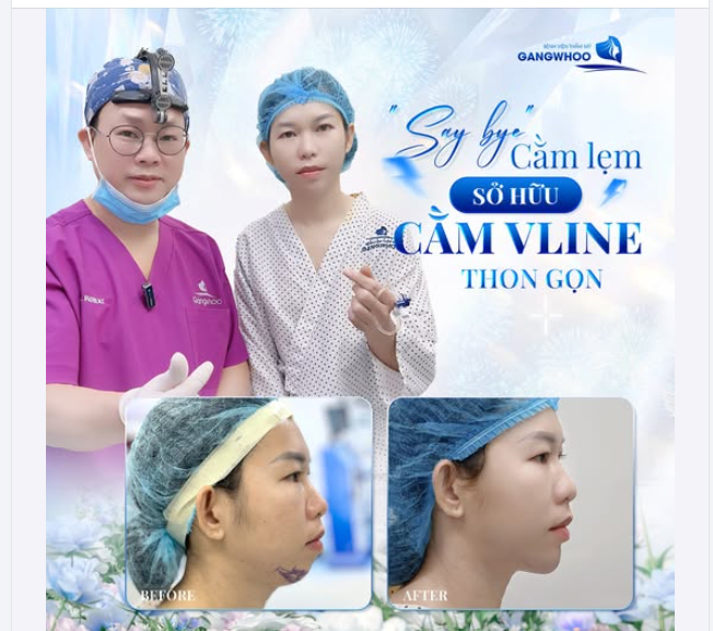 SAY BYE CẰM LẸM - SỞ HỮU CẰM VLINE THON GỌN