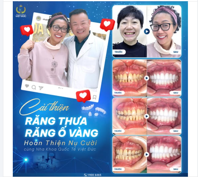 CHỊ LÊ HÀ QUẾ VÀ HÀNH TRÌNH "TRẺ HÓA" NHỜ BỌC RĂNG SỨ TẠI NHA KHOA QUỐC TẾ VIỆT ĐỨC