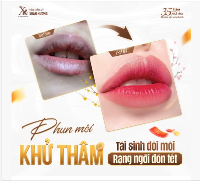 GIẢI CỨU' ĐÔI MÔI THÂM SẠM, KÉM SẮC VỚI CÔNG NGHỆ PHUN MÔI KHỬ THÂM NHÀ XUÂN HƯƠNG