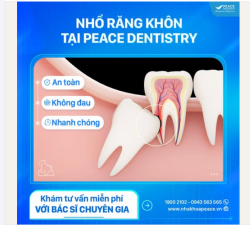 NHỔ RĂNG KHÔN TẠI PEACE DENTISTRY - TRẢI NGHIỆM ÊM ÁI, AN TÂM