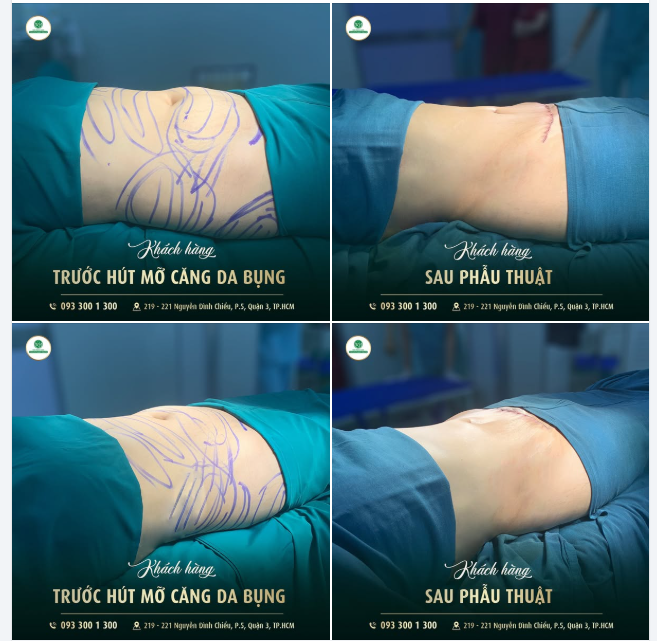 DÁNG XINH ĐÓN TẾT THÔI CÁC NÀNG ƠI!!