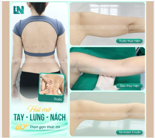 TAY NHỎ VAI THON – ĐÓN TẾT XINH