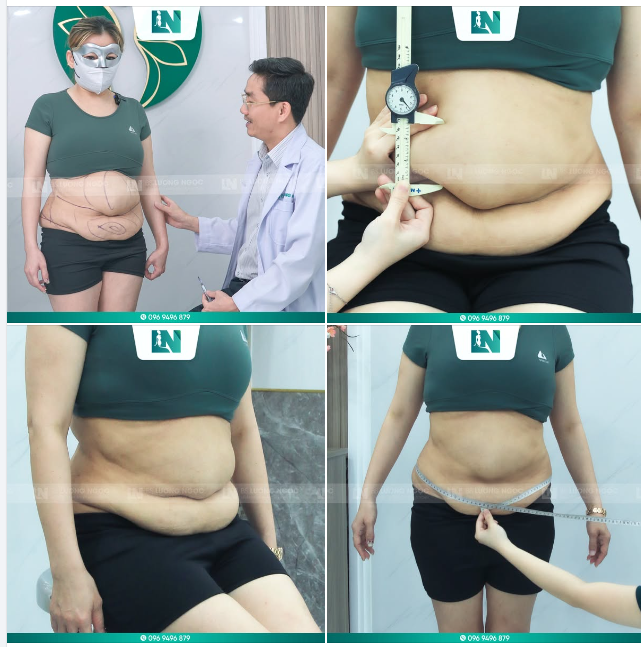 HÀNH TRÌNH THOÁT KHỎI CHIẾC BỤNG DỊ DẠNG