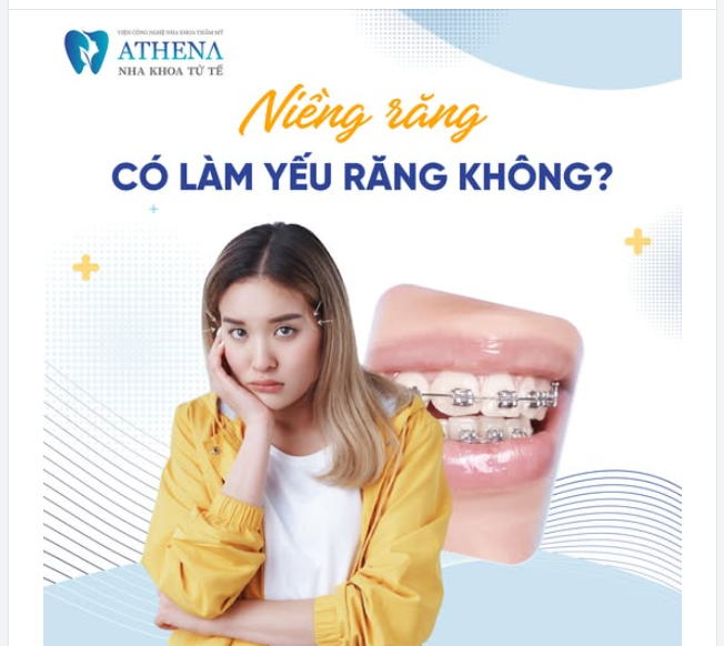 Niềng răng là một quá trình sử dụng lực nhẹ nhàng để di chuyển răng về vị trí mong muốn trên cung hàm.