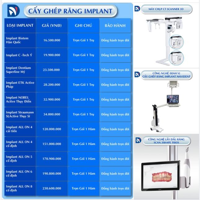 Cấy ghép Implant chuyên sâu: Minh bạch chi phí, hợp lý chi tiêu, chất lượng quốc tế.