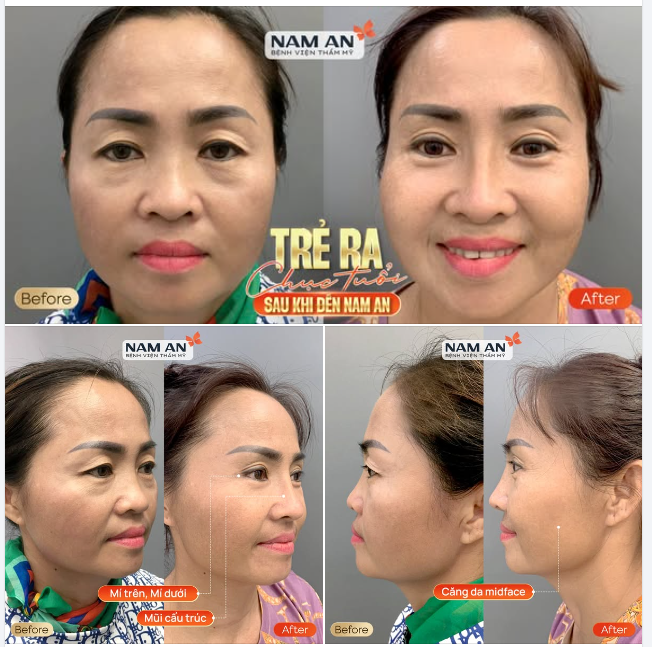 KHÁCH HÀNG NGOẠI QUỐC TRẺ RA CHỤC TUỔI