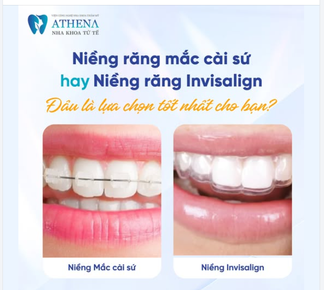 Niềng răng không chỉ là giải pháp cải thiện nụ cười mà còn là sự đầu tư cho sức khỏe và sự tự tin lâu dài.