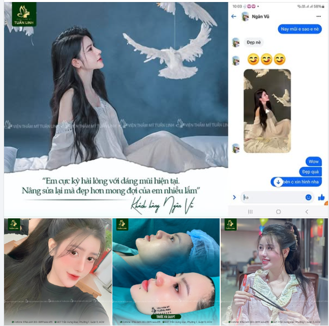 Chọn địa chỉ nâng mũi uy tín để có dáng mũi đẹp theo mong muốn và bền chắc dài lâu nha