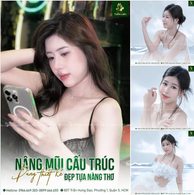 Sang chảnh, thanh tú với chiếc mũi cấu trúc thiết kế sau 2 tháng!!