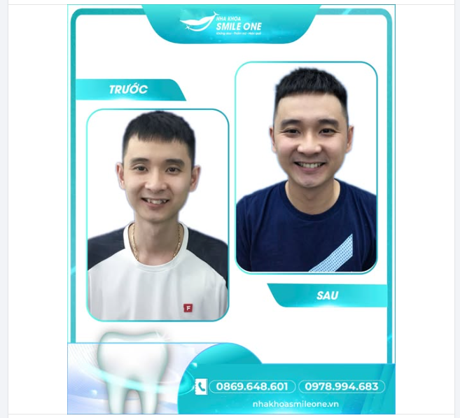 CHƯA BAO GIỜ LÀ QUÁ MUỘN ĐỂ THAY ĐỔI NỤ CƯỜI