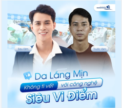 DA LÁNG MỊN - KHÔNG TÌ VẾT VỚI CÔNG NGHỆ SIÊU VI ĐIỂM