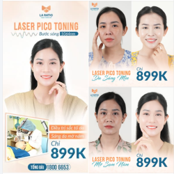 LASER PICO TONING ƯU ĐÃI KHỦNG - CHỈ 899K