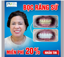 BỌC RĂNG SỨ - CƯỜI SANG TRỌNG CHUẨN DOANH NHÂN