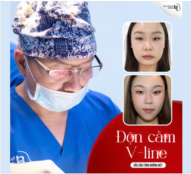 ĐỘN CẰM V-LINE  Gương mặt sắc nét - thanh tú - kiêu sa