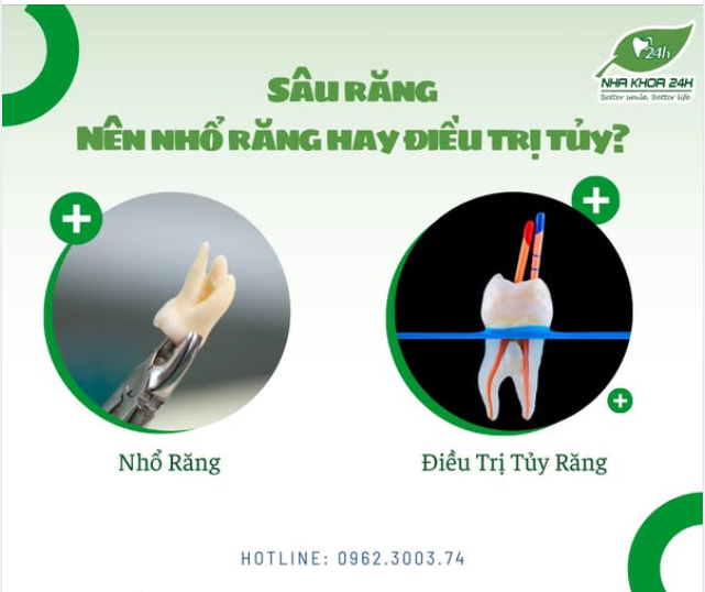 SÂU RĂNG NÊN NHỔ RĂNG HAY ĐIỀU TRỊ TỦY