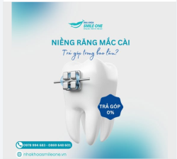 TRẢ-GÓP NIỀNG RĂNG TẠI SMILE ONE – KHÔNG CÒN GÁNH NẶNG CHI PHÍ!