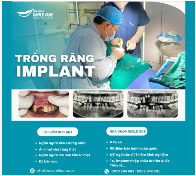 TẠI SAO NGÀY CÀNG NHIỀU NGƯỜI LỰA CHỌN TRỒNG IMPLANT TẠI SMILE ONE?