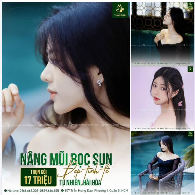 Chỉ còn 19ngày để nâng mũi xinh, tự tin đón Tết!