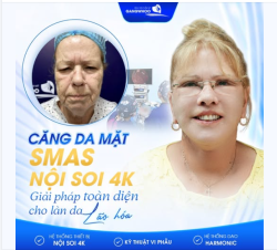 CĂNG DA MẶT SMAS NỘI SOI 4K GIẢI PHÁP CHO LÀN DA LÃO HÓA