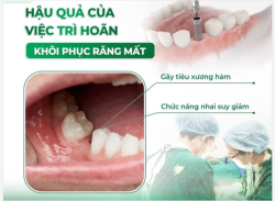 HẬU QUẢ CỦA VIỆC TRÌ HOÃN KHÔI PHỤC RĂNG MẤT