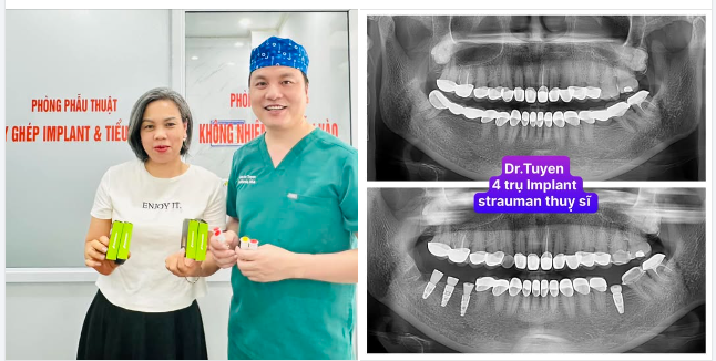 Quy Trình Cấy Ghép Răng Implant Có Phức Tạp Không?