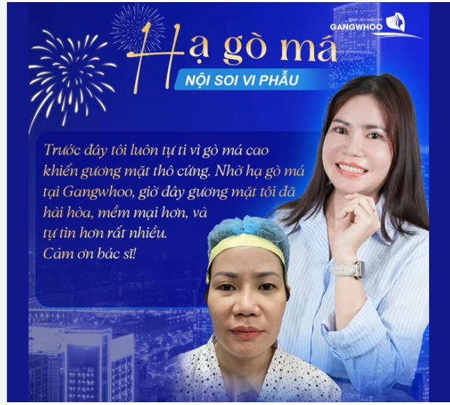 HẠ GÒ MÁ NỘI SOI VI PHẪU LỰA CHỌN HOÀN HẢO CHO NHAN SẮC HÀI HÒA TỰ NHIÊN