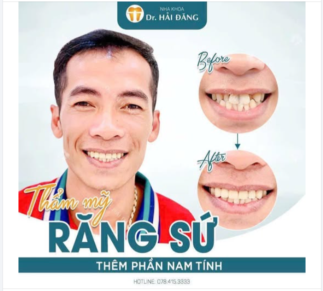 RĂNG SỨ HOÀN HẢO - TỰ TIN CHÀO NĂM MỚI