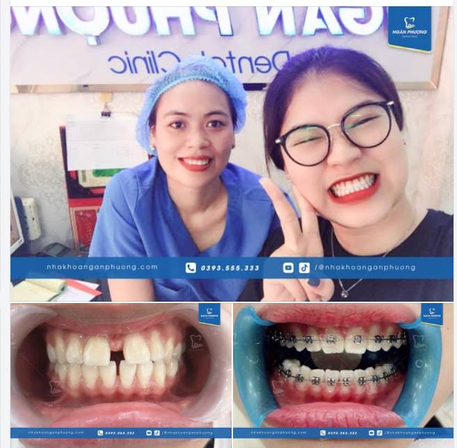 Ảnh hơi mờ chứ nụ cười này chắc chắn mờ ê mê