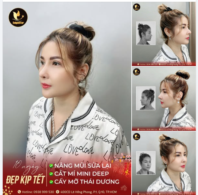 10 NGÀY THỰC HIỆN - ĐẸP NGAY KỊP TẾT