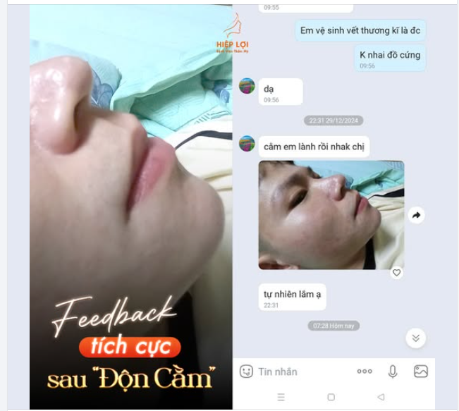 FEEDBACK thực tế của khách hàng nhà Hiệp Lợi