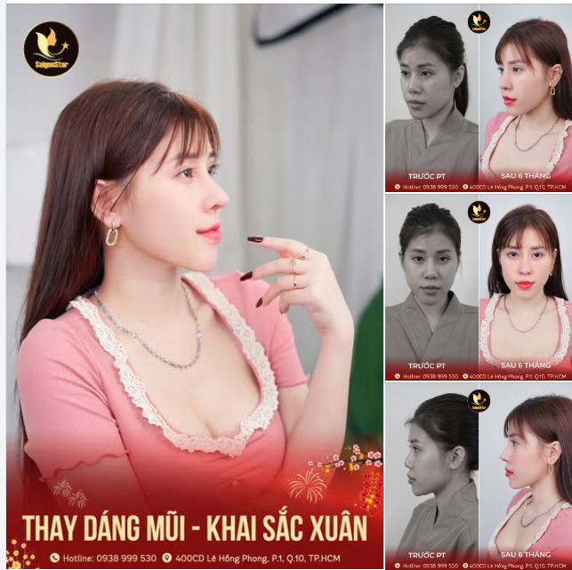 TẾT ĐẾN XUÂN VỀ!!! THAY DÁNG MŨI - KHAI SẮC XUÂN CÙNG DR.HOẠT NHÉ!